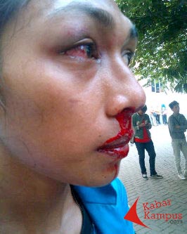 Ibu Korban Pemukulan Oknum Polisi : “Kita orang kecil Nak…!”