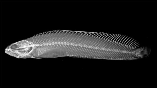 Hasil pemindaian x-ray ikan ‘Criscross Prickleback’, dengan sirip berduri yang panjang, dan berbentuk tajam di punggungnya. (Foto: Smithsonian Institution/Sandra J. Raredon)