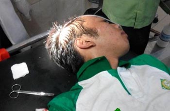 Demo Kenaikan BBM, Mahasiswa Jambi Babak Belur Dihajar Polisi