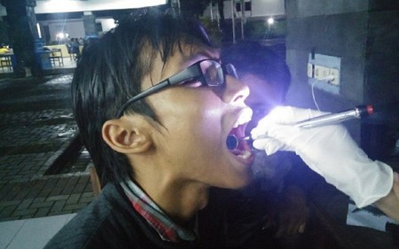 Mahasiswa UGM kembangkan Mediglow untuk mudahkan pemeriksaan gigi. Foto : UGM