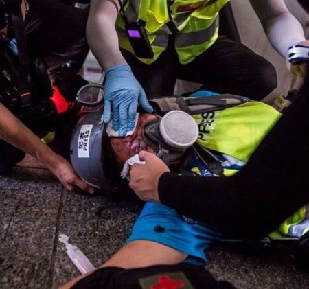 Jurnalis Indonesia Tertembak Pada Mata Saat Meliput Demontrasi di Honkong