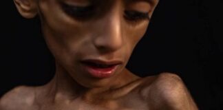 1,1 Juta Anak Gaza Hidup dalam Mimpi Buruk