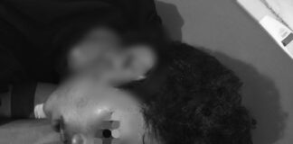 Dua Mahasiswa UNM Terluka Usai Diserang Bom Molotov